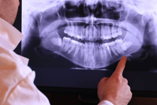 Best Emergency Dental Services for Seniors in Selah, WA